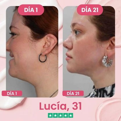 Solabela ™ Lift