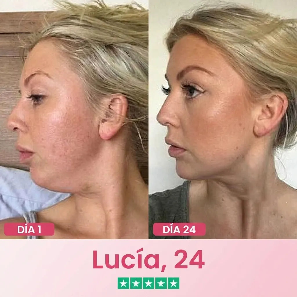 Solabela ™ Lift