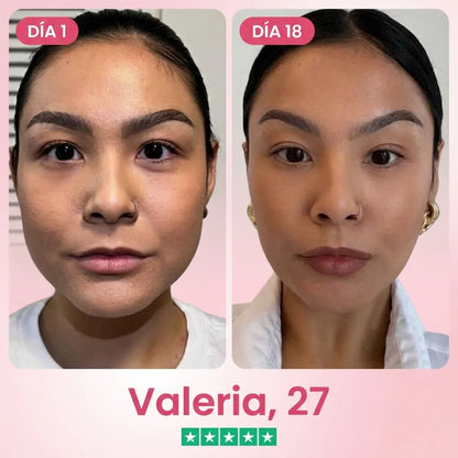 Solabela ™ Lift